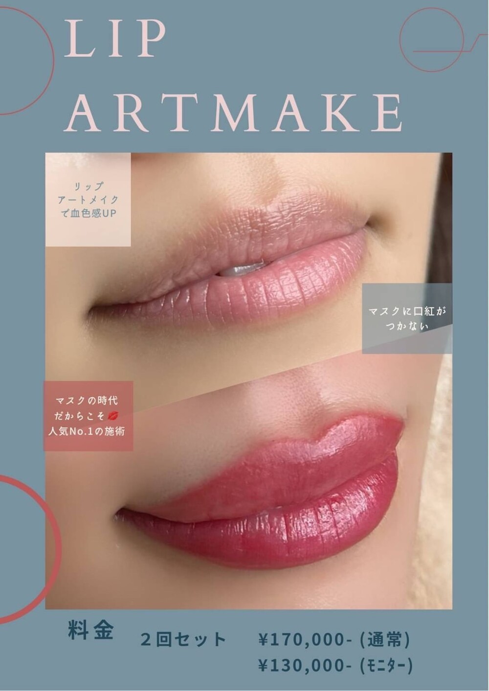 リップアートメイク アートメイクの症例写真 画像 美容皮膚科 Bella Beauty Clinic 大阪心斎橋院 ベラビューティークリニック Cs 美容医療の口コミ広場