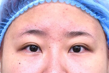 医療法人秀晄会 心斎橋コムロ美容外科クリニックの目・二重整形の症例写真