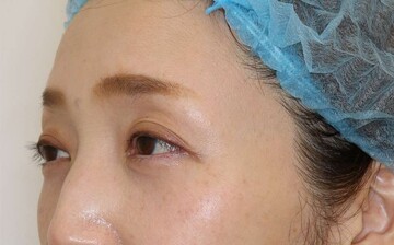 すなおクリニックの症例写真[アフター]