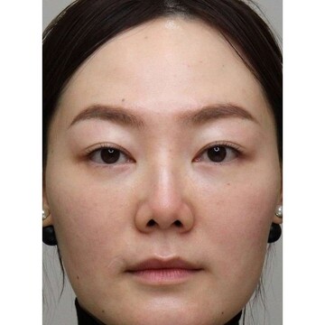 聖心美容クリニックの症例写真[アフター]