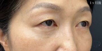 AI Beauty Clinicの症例写真[アフター]