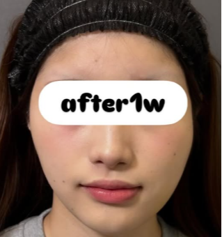Plume Clinicの症例写真[アフター]