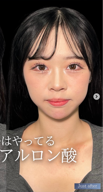 PRISM Beauty Clinicの症例写真[アフター]