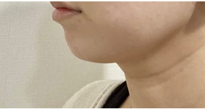 ペルラクリニック神宮前の症例写真[アフター]