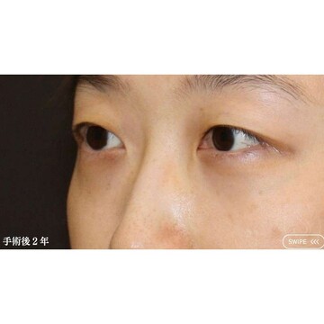聖心美容クリニックの症例写真[アフター]