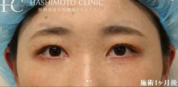 静岡美容外科橋本クリニックの症例写真[アフター]