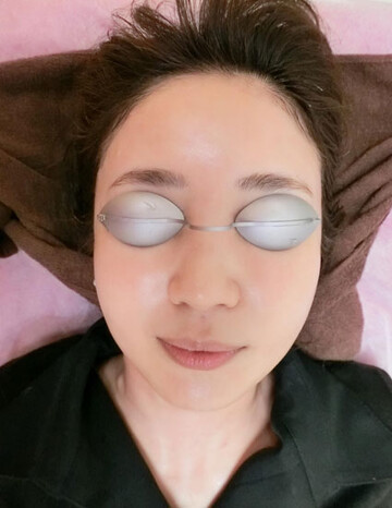 やさしい美容皮膚科・皮フ科 秋葉原院/シミレーザー東京のHIFU・照射系リフトアップ治療の症例写真[ビフォー]