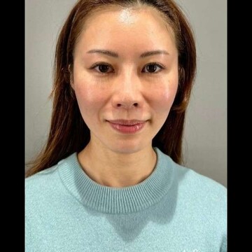 PRISM Beauty Clinicの症例写真[アフター]