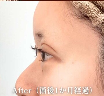 ギャラリークリニック銀座の症例写真[アフター]
