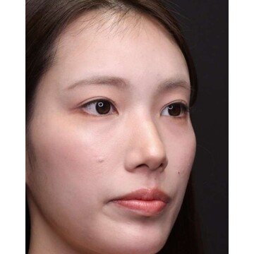 聖心美容クリニックの症例写真[アフター]