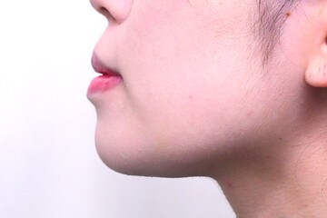 医療法人秀晄会 心斎橋コムロ美容外科クリニックの症例写真[アフター]