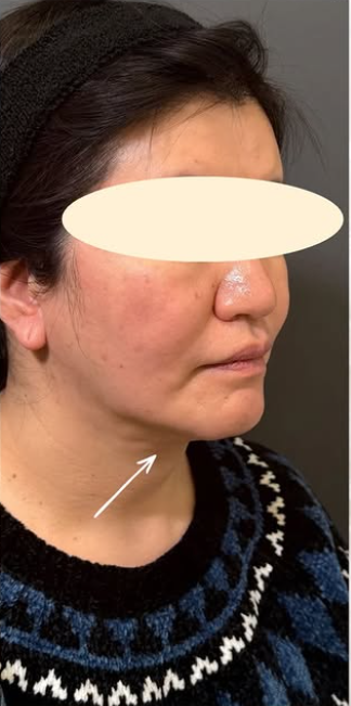 Plume Clinicの症例写真[アフター]