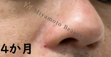 みやもと美容クリニックの症例写真[アフター]