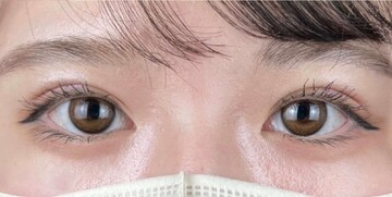 AI Beauty Clinicの症例写真[アフター]
