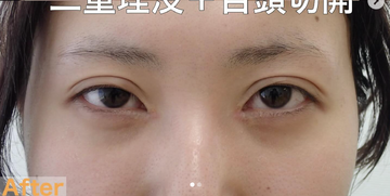 ニドークリニック 名古屋の症例写真[アフター]