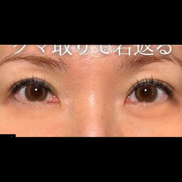 PRISM Beauty Clinicの症例写真[アフター]