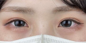 AI Beauty Clinicの症例写真[アフター]
