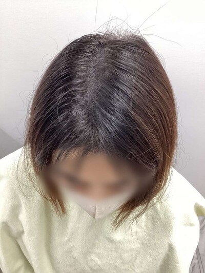 ヘアアートメイク｜50代｜2回の症例写真[アフター]