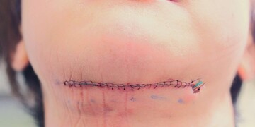 医療法人秀晄会 心斎橋コムロ美容外科クリニックの症例写真[アフター]