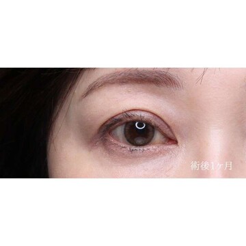 聖心美容クリニックの症例写真[アフター]