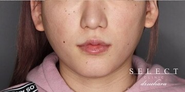 Select Clinic セレクトクリニック 表参道院の症例写真 美容医療の口コミ広場