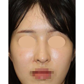 聖心美容クリニックの症例写真[アフター]