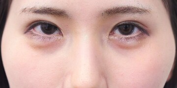 医療法人秀晄会 心斎橋コムロ美容外科クリニックの症例写真[アフター]
