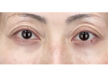 AI Beauty Clinicの症例写真[アフター]