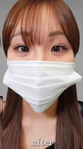 Plume Clinicの症例写真[アフター]