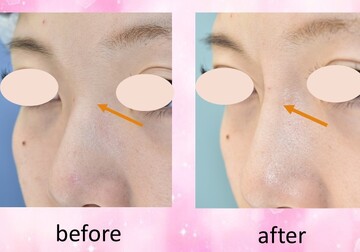 湘南美容クリニック 長野院の鼻の整形 美容医療の口コミ広場