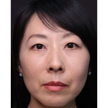 聖心美容クリニックの症例写真[アフター]