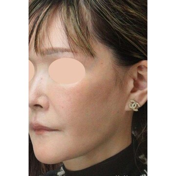 聖心美容クリニックの症例写真[アフター]