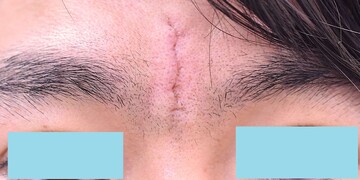 医療法人秀晄会 心斎橋コムロ美容外科クリニックの症例写真[アフター]