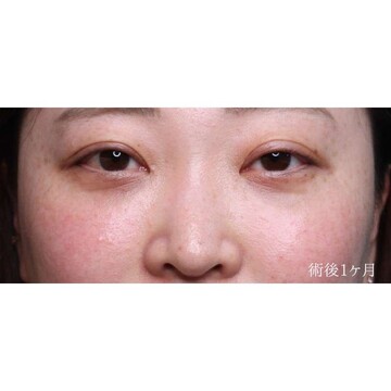 聖心美容クリニックの症例写真[アフター]