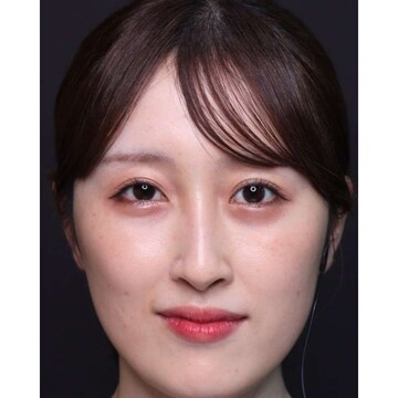 聖心美容クリニックの症例写真[アフター]