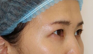 すなおクリニックの症例写真[アフター]