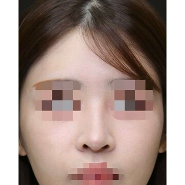 聖心美容クリニックの症例写真[アフター]
