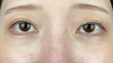 AI Beauty Clinicの症例写真[アフター]