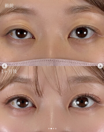 CLINIC Wの目・二重整形の症例写真