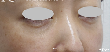 静岡美容外科橋本クリニックの症例写真[アフター]