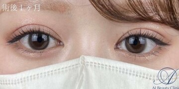 AI Beauty Clinicの症例写真[アフター]