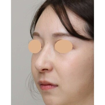 聖心美容クリニックの症例写真[アフター]