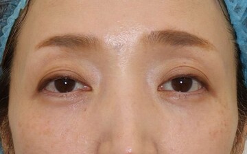 すなおクリニックの症例写真[アフター]