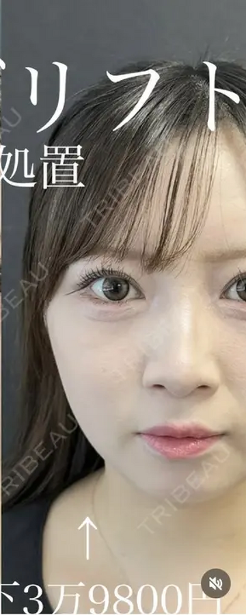 ルラ（LULA）美容クリニックの症例写真[アフター]
