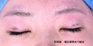 医療法人秀晄会 心斎橋コムロ美容外科クリニックの症例写真[アフター]