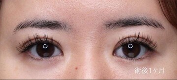 聖心美容クリニックの症例写真[アフター]