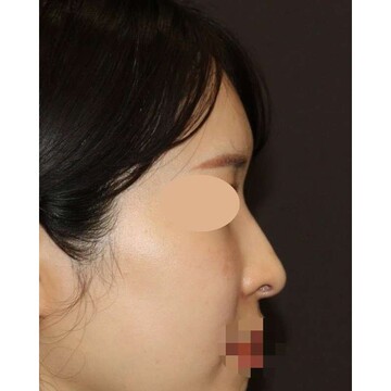 聖心美容クリニックの症例写真[アフター]