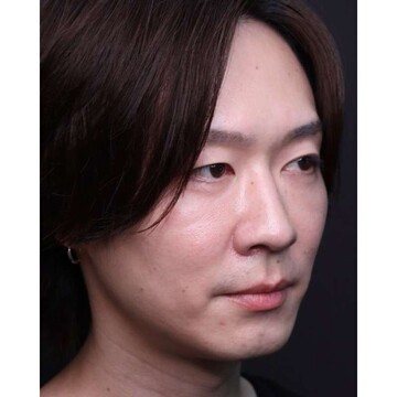 聖心美容クリニックの症例写真[アフター]