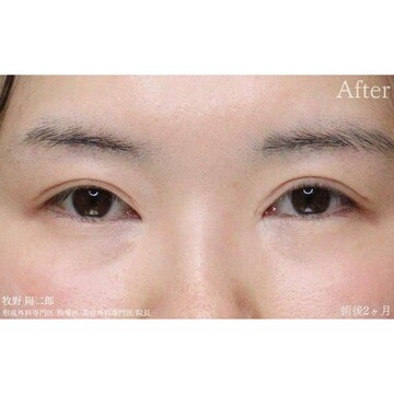 聖心美容クリニックの症例写真[アフター]