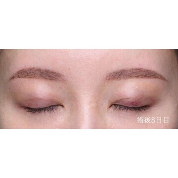 聖心美容クリニックの症例写真[アフター]